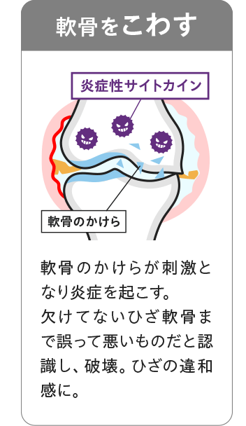 【図:軟骨をこわす】軟骨のかけらが刺激となり炎症を起こす。欠けてないひざ軟骨まで誤って悪いものだと認識し、破壊。ひざの違和感に。