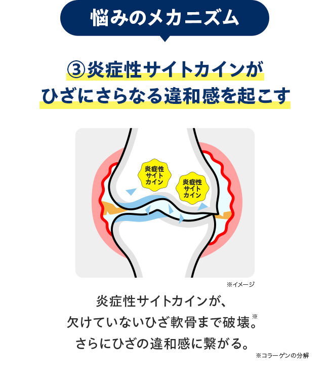 悩みのメカニズム：③炎症性サイトカインがひざにさらなる違和感を起こす／炎症性サイトカインが、欠けていないひざ軟骨まで破壊※。さらにひざの違和感に繋がる。※コラーゲンの分解