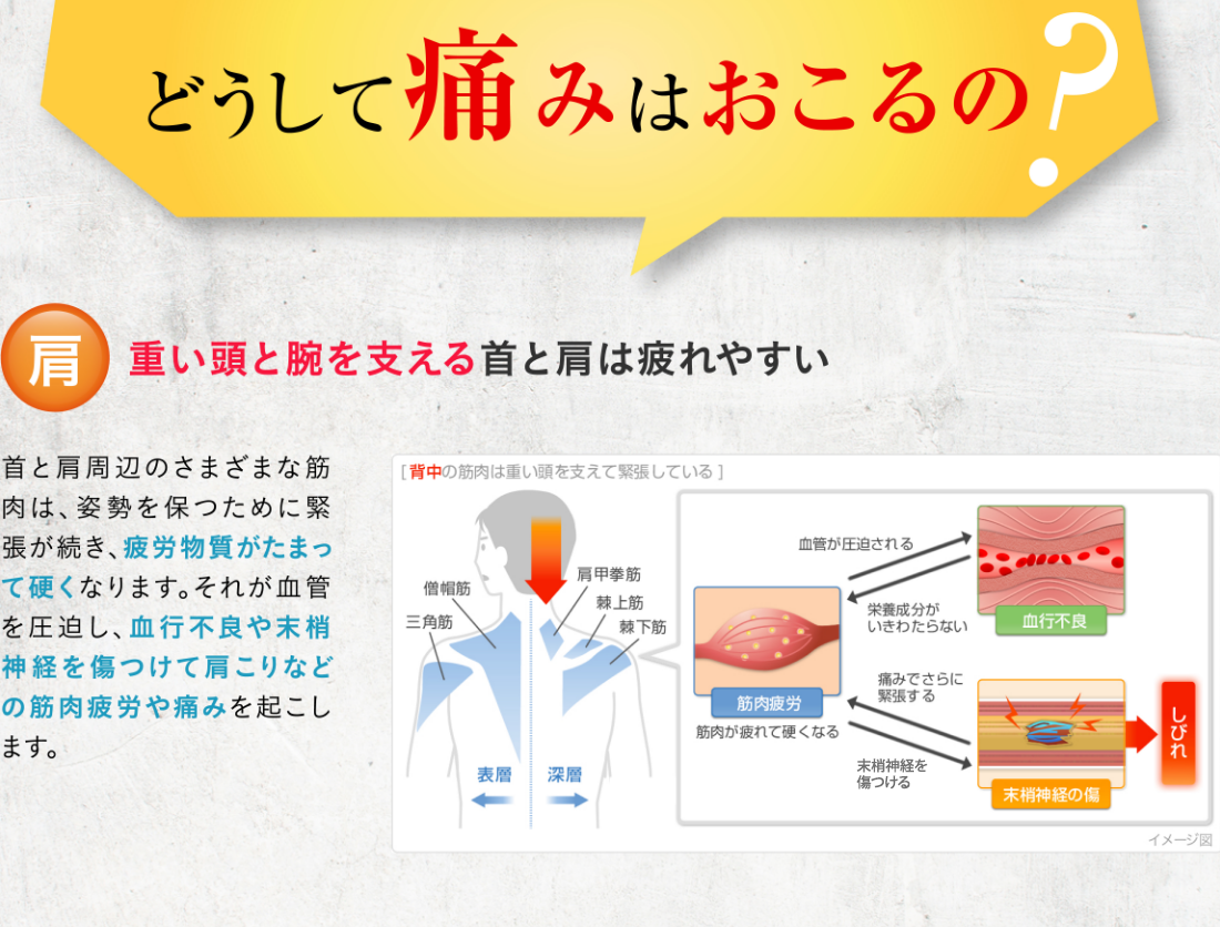 どうして痛みはおこるの？ 肩 重い頭と腕を支える首と肩は疲れやすい 首と肩周辺のさまざまな筋肉は、姿勢を保つために緊張が続き、疲労物質がたまって硬くなります。それが血管を圧迫し、血行不良や末梢神経を傷つけて肩こりなどの筋肉疲労や痛みを起こします。
