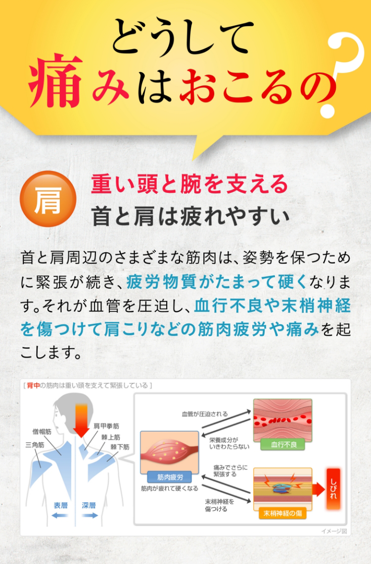 どうして痛みはおこるの？ 肩 重い頭と腕を支える首と肩は疲れやすい 首と肩周辺のさまざまな筋肉は、姿勢を保つために緊張が続き、疲労物質がたまって硬くなります。それが血管を圧迫し、血行不良や末梢神経を傷つけて肩こりなどの筋肉疲労や痛みを起こします。