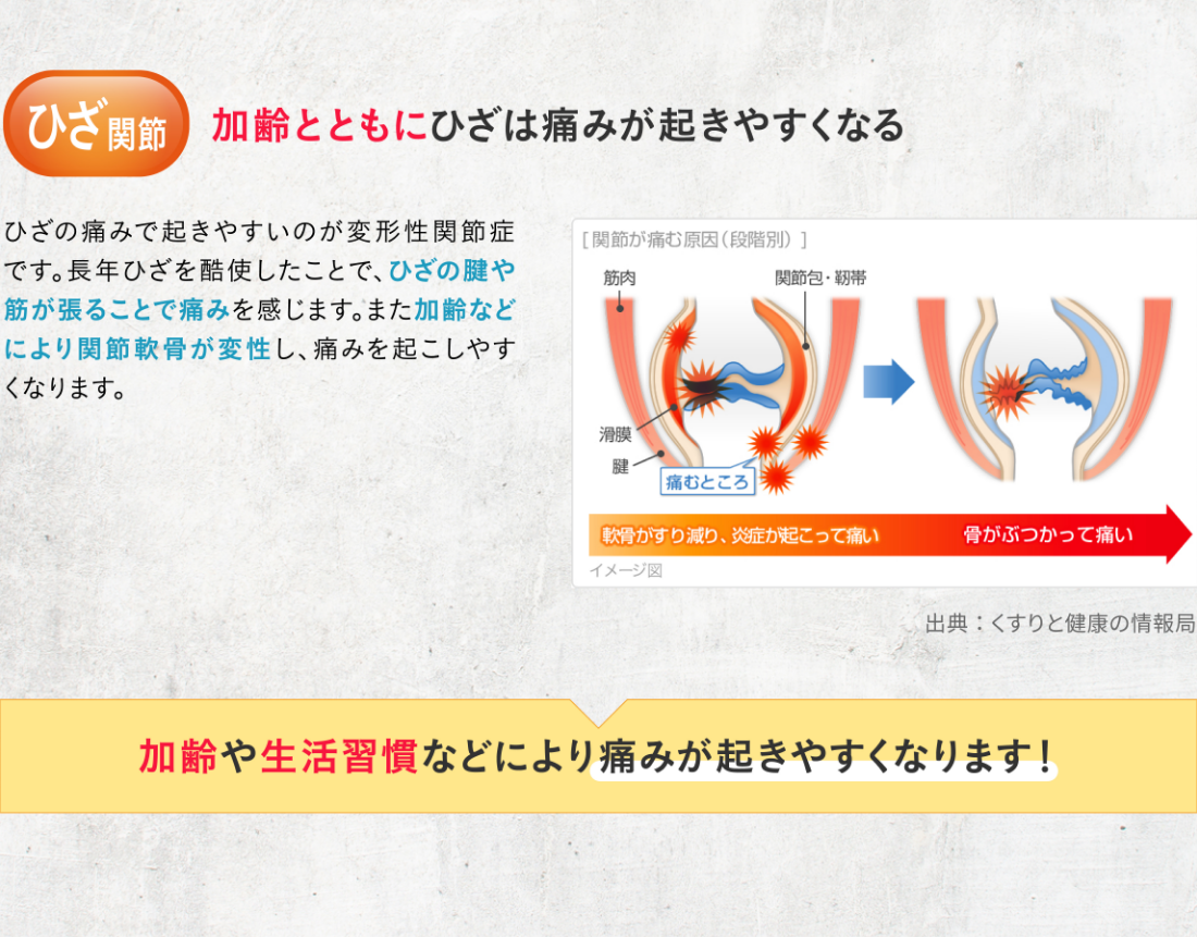 ひざ関節 加齢とともにひざは痛みが起きやすくなる ひざの痛みで起きやすいのが変形性関節症です。長年ひざを酷使したことで、ひざの腱や筋が張ることで痛みを感じます。また加齢などにより関節軟骨が変性し、痛みを起こしやすくなります。