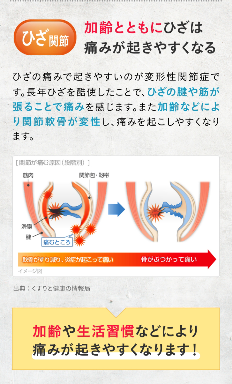 ひざ関節 加齢とともにひざは痛みが起きやすくなる ひざの痛みで起きやすいのが変形性関節症です。長年ひざを酷使したことで、ひざの腱や筋が張ることで痛みを感じます。また加齢などにより関節軟骨が変性し、痛みを起こしやすくなります。